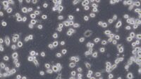 Rounded cells after trypsin-treatment under the microscope.