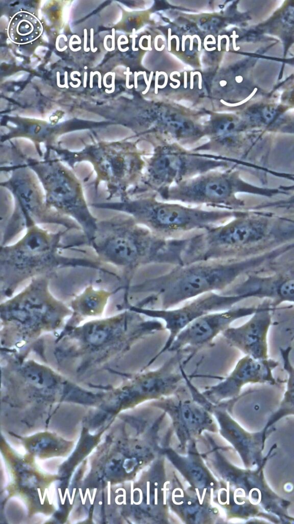 Cells attached to cell culture flasks starting to detach, one after the other, then, with a gush of cell culture medium the cells are afloat.